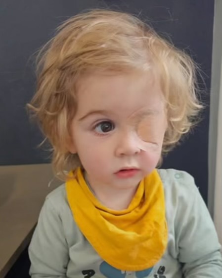 کودک دو ساله پس از بوسیده شدن توسط فرد مبتلا به تبخال دهانی، بینایی خود را از دست داد